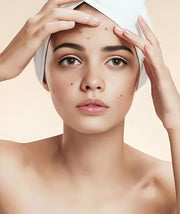 Red Light Therapy for Acne: What You Need To Know