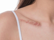 Home LED Red Light Therapy for Scars