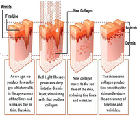 LED Infrared & Red Light Therapy 1000 Super