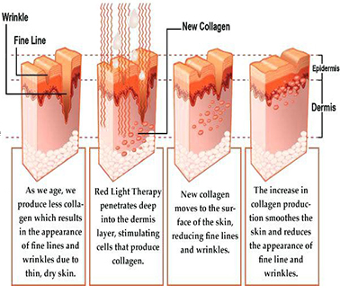 LED Infrared & Red Light Therapy 1000 Super