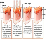 Load image into Gallery viewer, LED Infrared &amp; Red Light Therapy 500 Midi
