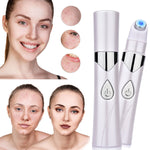 Load image into Gallery viewer, Acne &amp; Skin Rejuvenation Ultrasonic Light Therapy Treatment Device
