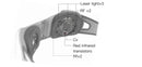 LASTEK® Cold Laser Slimming Belt Lose Weight Therapy Device